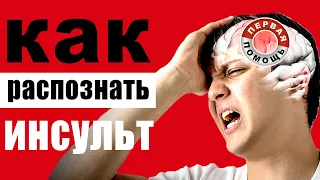 Первые признаки инсульта - как распознать и быстро среагировать