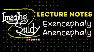 Exencephaly - Anencephaly: Imaging Study Lecture