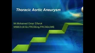 THORACIC AORTIC ANEURYSM LECTURE