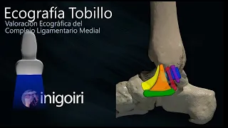 Ecografía de tobillo: Valoración del ecográfica del ligamento lateral interno y Spring