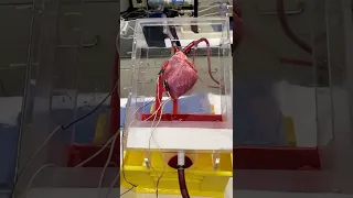 Studying pig hearts for transplantation