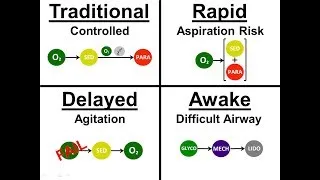 Introduction to Intubation - 01 - Approach: Sequence