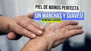 Remedios Caseros para Quitar Manchas de las Manos | Piel Impecable en Casa