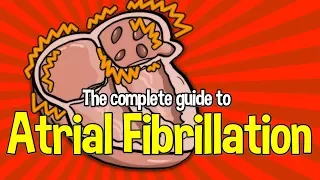 Complete Guide To Atrial Fibrillation: Causes, symptoms and treatments