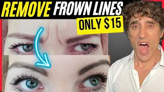 EASILY REMOVE YOUR FROWN LINES AT HOME FOR UNDER $15