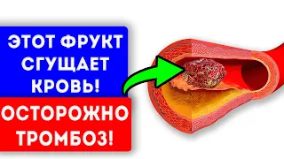 Осторожно, тромбы! 7 продуктов, которые превращают кровь в желе. Варикоз, тромбы, тромбофлебит