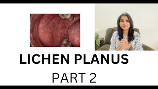 ORAL LICHEN PLANUS PART 2 - CLINICAL FEATURES, ORAL MANIFESTATIONS I SKIN DISEASES I LICHEN PLANUS