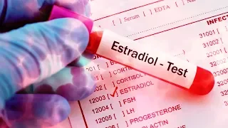 Why You NEED To Get A SENSITIVE ASSAY Estradiol Test | The Mistake 9/10 Men Make