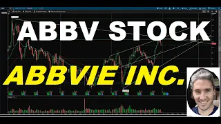Abbvie Inc. (ABBV) Stock - Technical Analysis