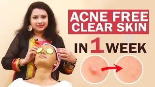 Remove Pimple&Acne in 1week | Easy Face-pack | Overnight | Pimple