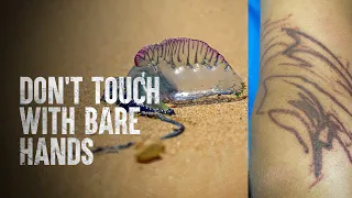 How to Survive a Portuguese Man O' War