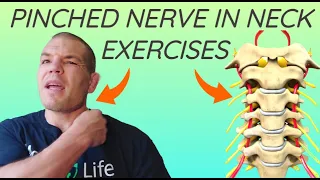 Pinched Nerve In Neck? - Exercises For A Pinched Nerve In Your Neck