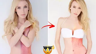 Taylor Muhl _ Women Born With a Unique Birthmark 😮
