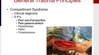 MILLER'S 2016 Orthopaedics: Trauma. Pelvis and Upper Extremity