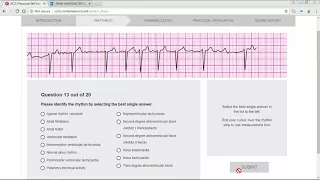 ACLS Precourse ECG Rhythm