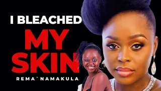 Rema Namakula and the Grand Masters of Skin Bleaching