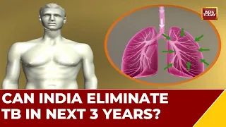 Tuberculosis In India: Road to Elimination |‘Pradhan Mantri TB Mukt Bharat Abhiyaan’ To Eliminate TB