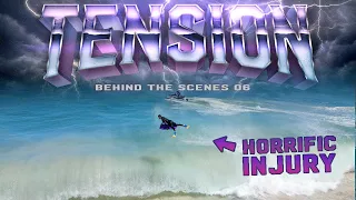 Tension 11 BTS E06 Horrific Injury Tow Surfing