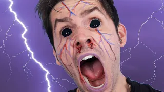 BOY STRUCK BY LIGHTNING!