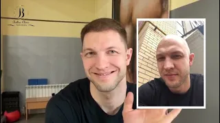 Результат пересадки волос в BELLUS CLINIC, Сергей из России