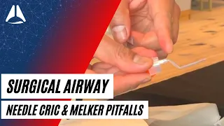 Pitfalls with needle cricothyroidotomy and Melker kits in CICO crises | Airway Management