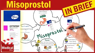 Misoprostol (Cytotec): What is Misoprostol Used For? Misoprostol 200 mcg Uses, Dose & Side Effects