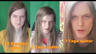 7 Tage nach einer Corona-Impfung (Video-Tagebuch eines Mädchens)