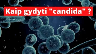 Kaip gydyti "candida" ?