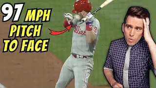 Bryce Harper Survives 97MPH PITCH to the FACE - A Medical Breakdown