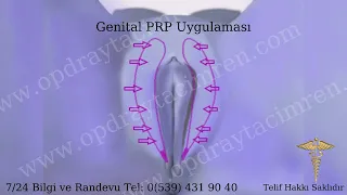 Genital PRP Nedir? Orgazm Aşısı Nasıl Yapılır? Genital Gençleştirme