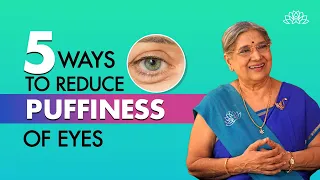 Home Remedies for Puffy Eyes I Treat puffy eyes naturally I Dr. Hansaji