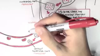 Malaria - Plasmodium