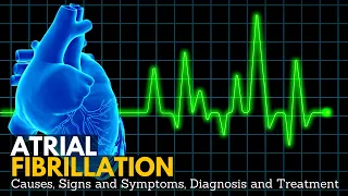 Atrial Fibrillation, Causes, Signs and Symptoms, Diagnosis and Treatment