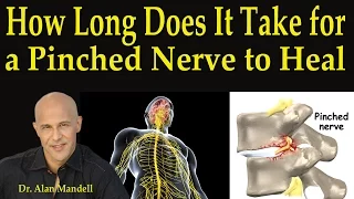 How Long Does It Take For A Pinched Nerve to Heal - Dr Mandell