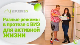Виталий Руденко о новом протезе с внешним источником питания.