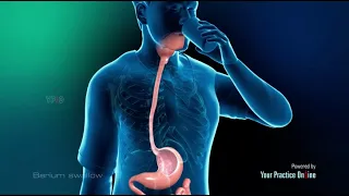 Animation of Barium Swallow