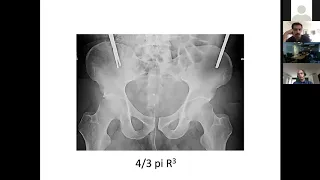 Pelvic Ring Evaluation and Management - Dr. Saam Morshed