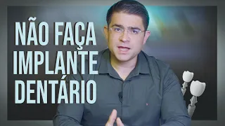 Não faça implante dentário antes de assistir esse vídeo!