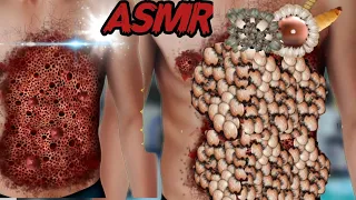 ASMR Removal Dog.fi Ticks & Maggot Infected Belly | Severely Injured Animation filmi asmr