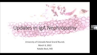 "Updates in IgA Nephropathy" presented by Natalie Beck, MD