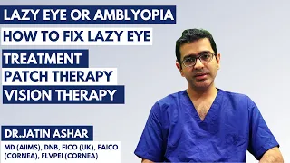 Amblyopia (Lazy Eye) | Meaning | Treatment of Amblyopia (Lazy Eye) | Patch & Vision Therapy Exercise