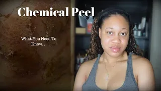 The Benefits Of A Chemical Peel, How They Work & The Types | EuniyceMari