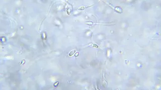 「見る菌」で観察した精子