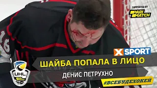 Шайба попала в лицо Денису Петрухно во время матча с Белым Барсом
