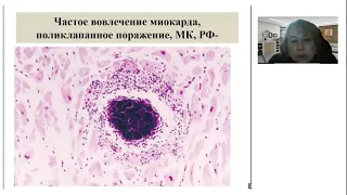 Школа клинического мышления педиатра. Инфекционный эндокардит у детей и подростков