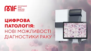 Діагностика раку вдвічі швидше! Як працює цифрова патологія?