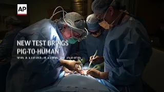 New test brings pig-to-human organ transplants closer