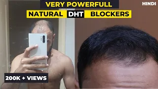 Very Powerful Natural DHT Blockers that will Stop Hair Loss in 2022