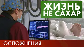 Осложнения диабета | Жизнь не сахар #14 (2019)