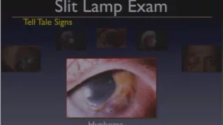 Trauma Of the Eye, Lecture .